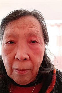 79岁大妈感恩分享用十三推拯救了93岁二次脑梗复发的老伴