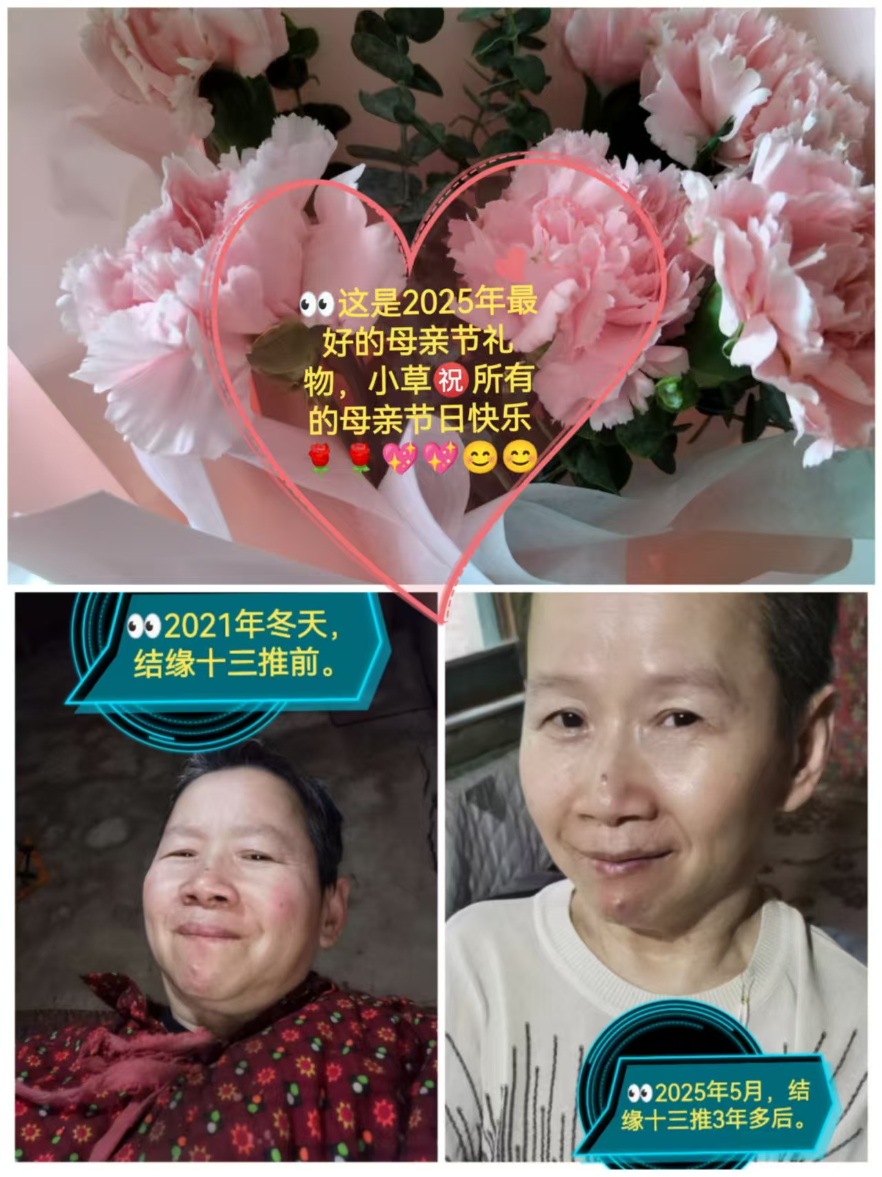 王宝莲分享：我与类风湿性关节炎抗争的二十多年经历和做十三推前后的变化及收获