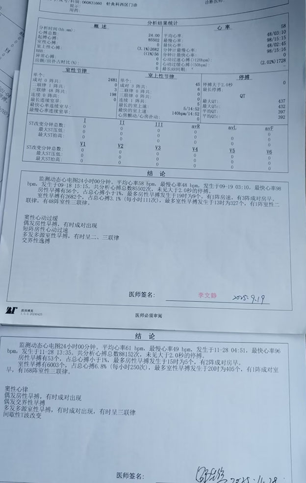 喝金酒室早变化分析